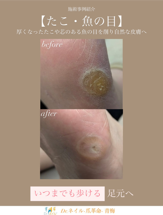 画像233