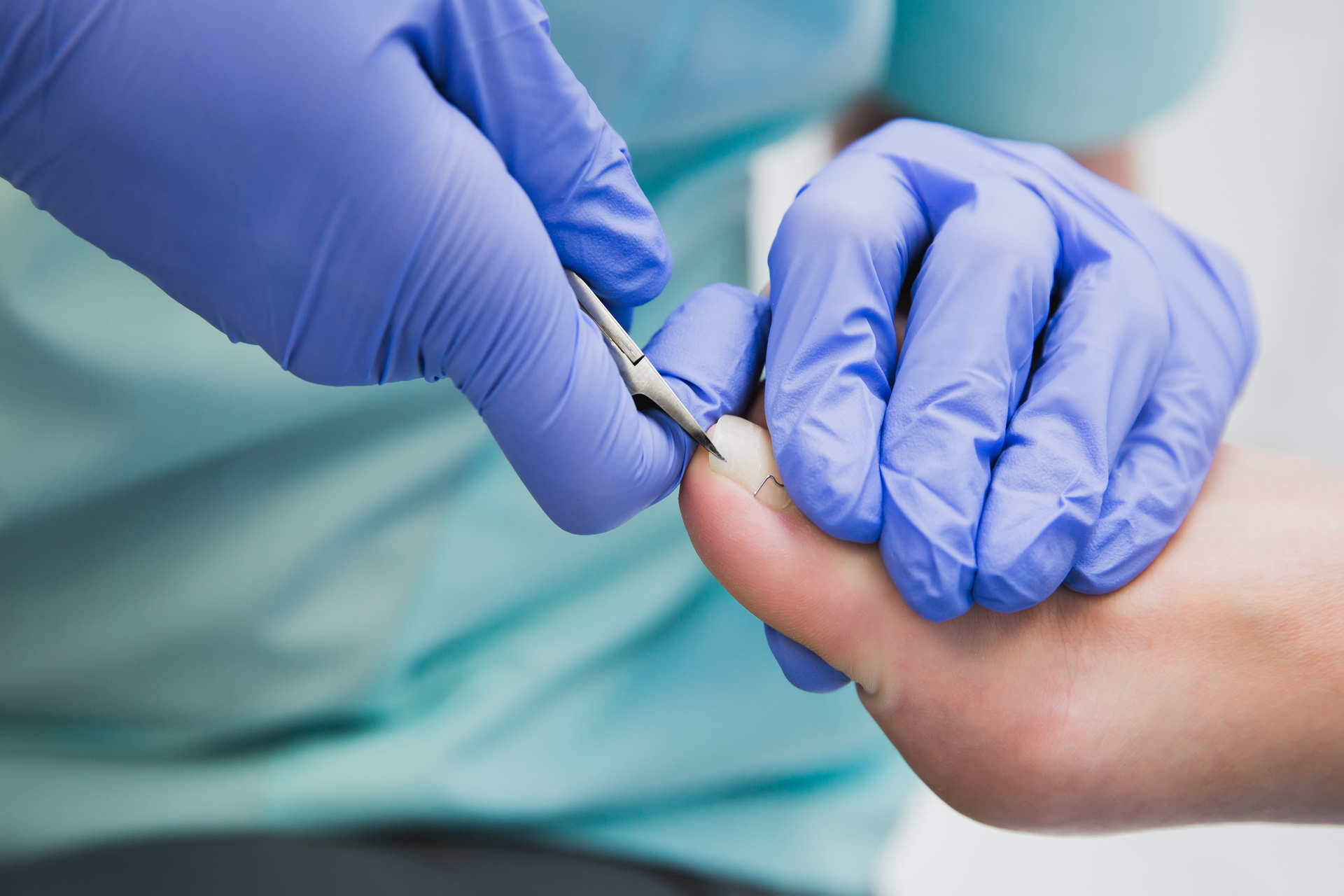 爪切りに対応 | 出張のフットケアならDr.ネイル爪革命青梅